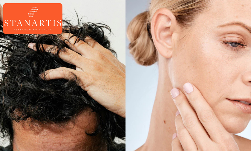Is Stanartis Skincare Good for Sensitive Skin?